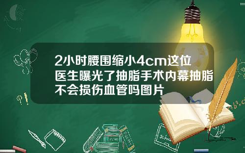 2小时腰围缩小4cm这位医生曝光了抽脂手术内幕抽脂不会损伤血管吗图片