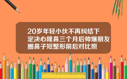 20岁年轻小伙不再纠结下定决心隆鼻三个月后帅爆朋友圈鼻子短整形前后对比照