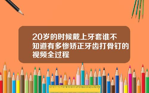 20岁的时候戴上牙套谁不知道有多惨矫正牙齿打骨钉的视频全过程
