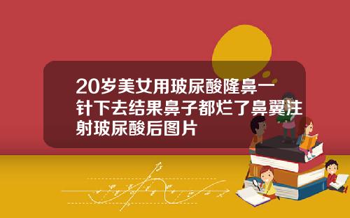 20岁美女用玻尿酸隆鼻一针下去结果鼻子都烂了鼻翼注射玻尿酸后图片