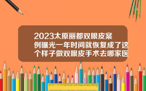 2023太原丽都双眼皮案例曝光一年时间就恢复成了这个样子做双眼皮手术去哪家医院好
