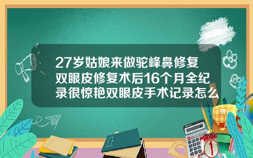 27岁姑娘来做驼峰鼻修复双眼皮修复术后16个月全纪录很惊艳双眼皮手术记录怎么写