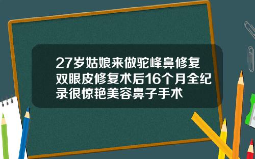 27岁姑娘来做驼峰鼻修复双眼皮修复术后16个月全纪录很惊艳美容鼻子手术