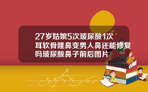 27岁姑娘5次玻尿酸1次耳软骨隆鼻变男人鼻还能修复吗玻尿酸鼻子前后图片