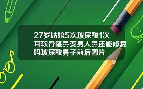 27岁姑娘5次玻尿酸1次耳软骨隆鼻变男人鼻还能修复吗玻尿酸鼻子前后图片