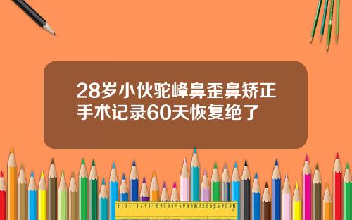 28岁小伙驼峰鼻歪鼻矫正手术记录60天恢复绝了