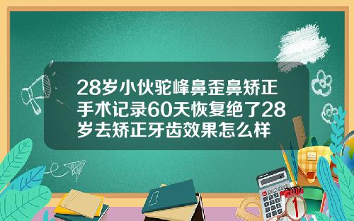 28岁小伙驼峰鼻歪鼻矫正手术记录60天恢复绝了28岁去矫正牙齿效果怎么样