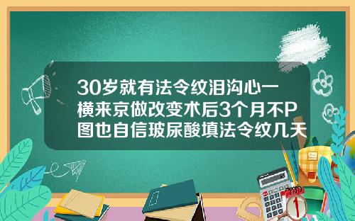 30岁就有法令纹泪沟心一横来京做改变术后3个月不P图也自信玻尿酸填法令纹几天自然