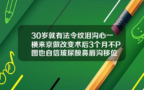 30岁就有法令纹泪沟心一横来京做改变术后3个月不P图也自信玻尿酸鼻唇沟移位