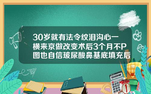 30岁就有法令纹泪沟心一横来京做改变术后3个月不P图也自信玻尿酸鼻基底填充后注意事项
