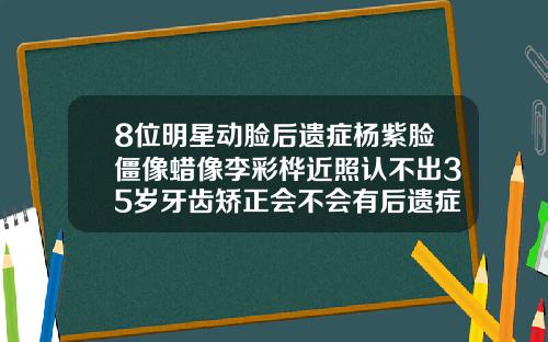 8位明星动脸后遗症杨紫脸僵像蜡像李彩桦近照认不出35岁牙齿矫正会不会有后遗症
