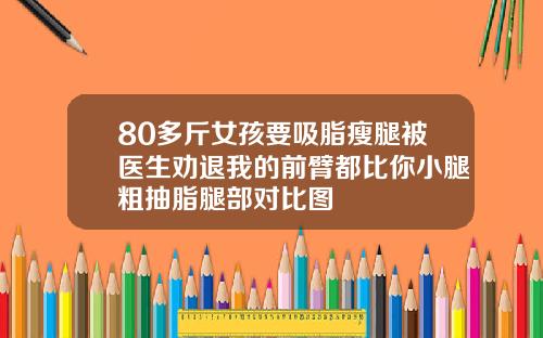80多斤女孩要吸脂瘦腿被医生劝退我的前臂都比你小腿粗抽脂腿部对比图