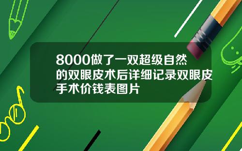 8000做了一双超级自然的双眼皮术后详细记录双眼皮手术价钱表图片