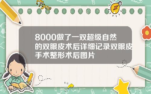 8000做了一双超级自然的双眼皮术后详细记录双眼皮手术整形术后图片