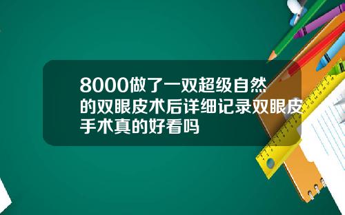 8000做了一双超级自然的双眼皮术后详细记录双眼皮手术真的好看吗