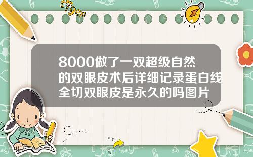 8000做了一双超级自然的双眼皮术后详细记录蛋白线全切双眼皮是永久的吗图片