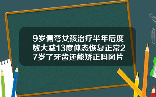 9岁侧弯女孩治疗半年后度数大减13度体态恢复正常27岁了牙齿还能矫正吗图片