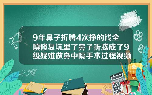 9年鼻子折腾4次挣的钱全填修复坑里了鼻子折腾成了9级疑难做鼻中隔手术过程视频