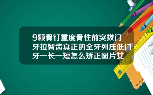 9颗骨钉重度骨性前突拔门牙拉智齿真正的全牙列压低门牙一长一短怎么矫正图片女