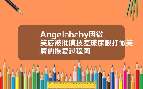 Angelababy因微笑唇被批演技差玻尿酸打微笑唇的恢复过程图