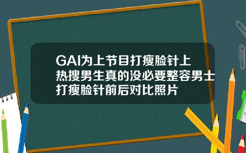GAI为上节目打瘦脸针上热搜男生真的没必要整容男士打瘦脸针前后对比照片