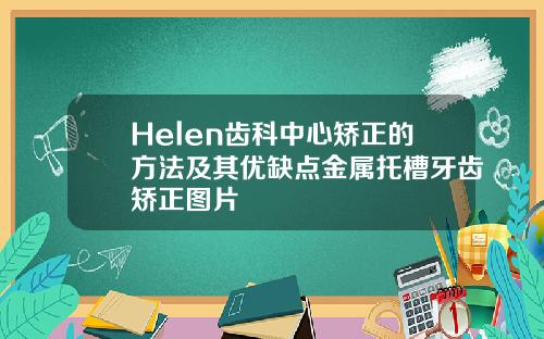 Helen齿科中心矫正的方法及其优缺点金属托槽牙齿矫正图片