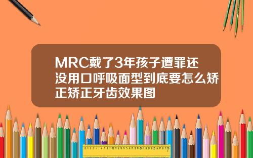 MRC戴了3年孩子遭罪还没用口呼吸面型到底要怎么矫正矫正牙齿效果图