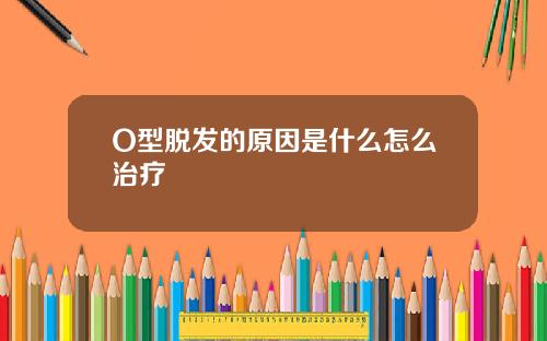O型脱发的原因是什么怎么治疗