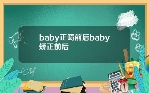 baby正畸前后baby矫正前后