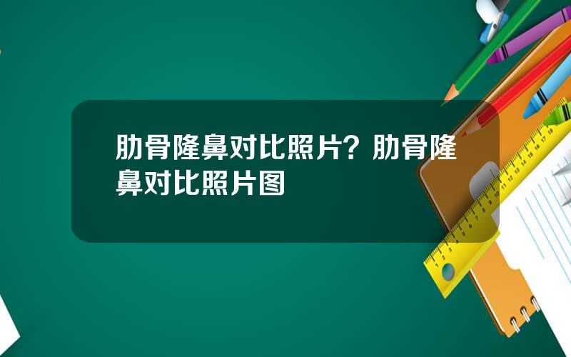肋骨隆鼻对比照片？肋骨隆鼻对比照片图